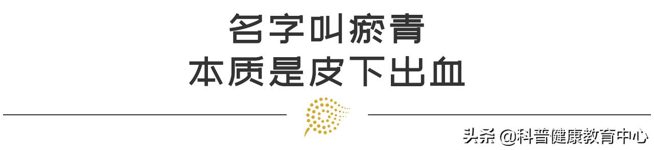 如何用红花油消退瘀青,摔伤淤青不消退是怎么回事