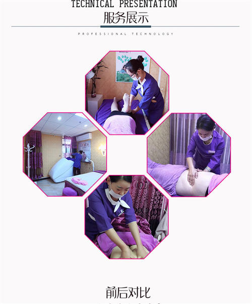 产后恢复有必要做骨盆修复吗,产后恢复有必要做盆底肌吗