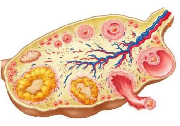 卵巢实性为主肿瘤，这13种你都想到了吗？