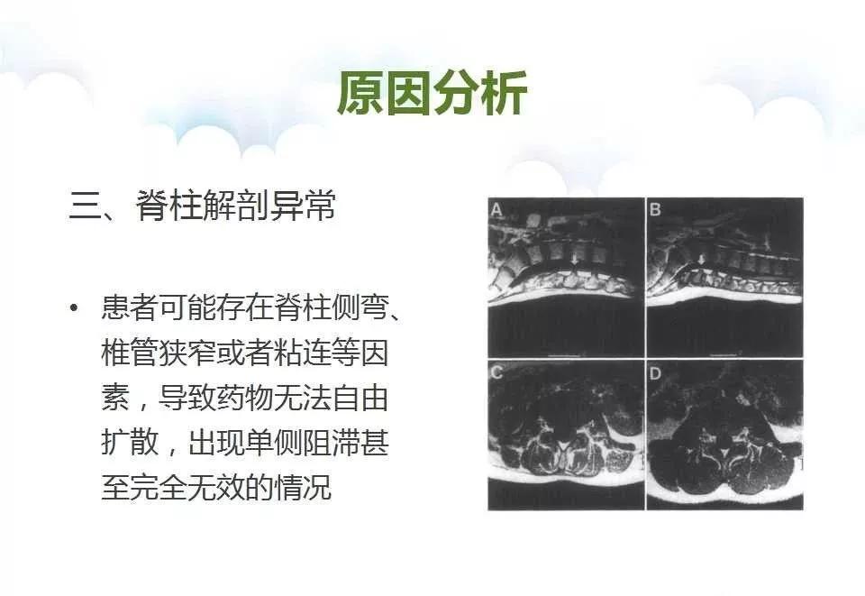 腰穿脑脊液有异常怎么治疗,腰麻脑脊液回流不畅