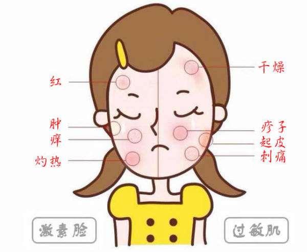 敏感肌红痒脱皮,敏感肌皮肤干燥起皮又痒要怎么办