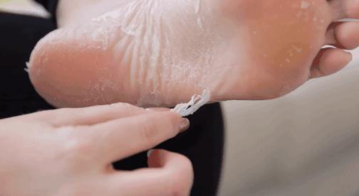 爽炸了!干丑裂的脚皮,一张完整撕掉,敢跟婴儿比姣嫩!