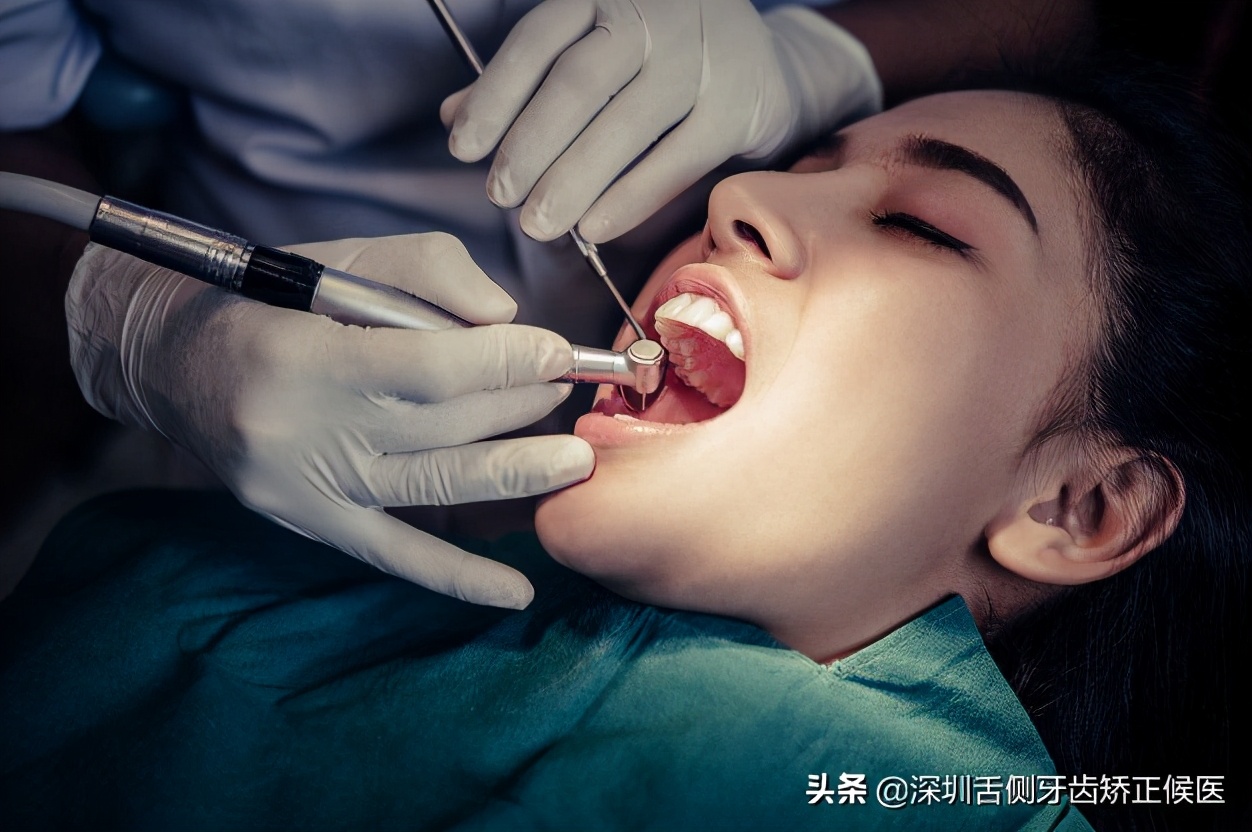 牙齿咬合面有黑线怎么办,牙齿里的坏水