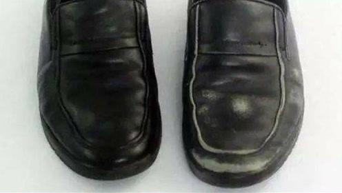 穿皮鞋磨破了脚抹什么东西,皮鞋被蹭掉一块皮怎么办