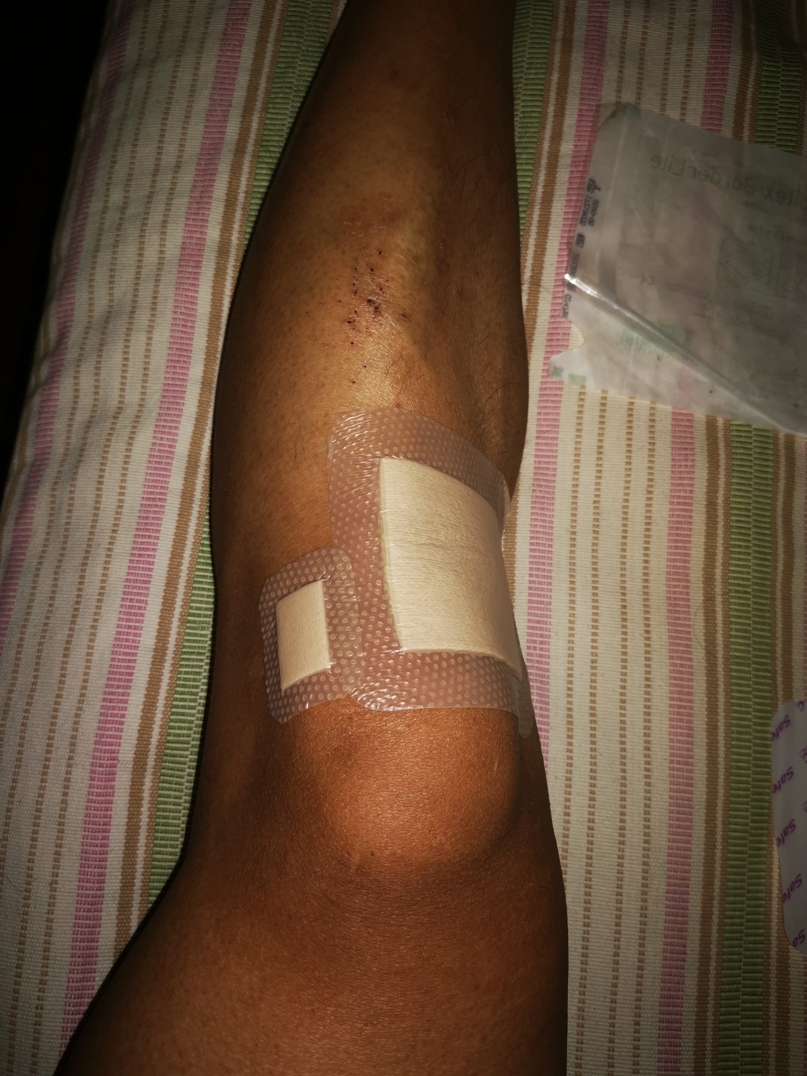 瑞典墨尼克疤痕贴,瑞典墨尼克敷料