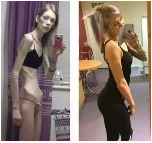 减肥瘦下来后肚子皮肤松弛怎么办,减肥瘦下来脸上皮肤松弛了怎么办