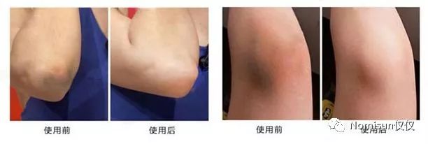 鐢风敓姝㈡,鐢风敓姝㈡浜庢毀鏄ф湡