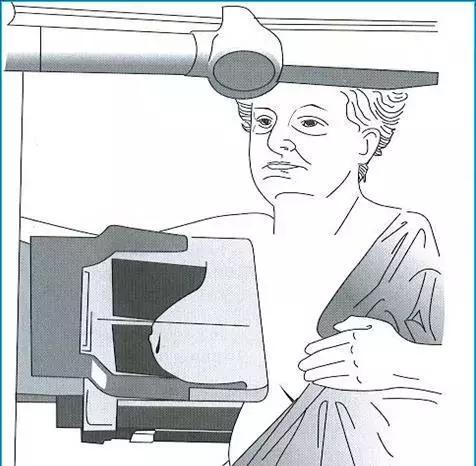 乳房肿块和纤维腺瘤,乳腺纤维腺瘤肿块有无血流信号