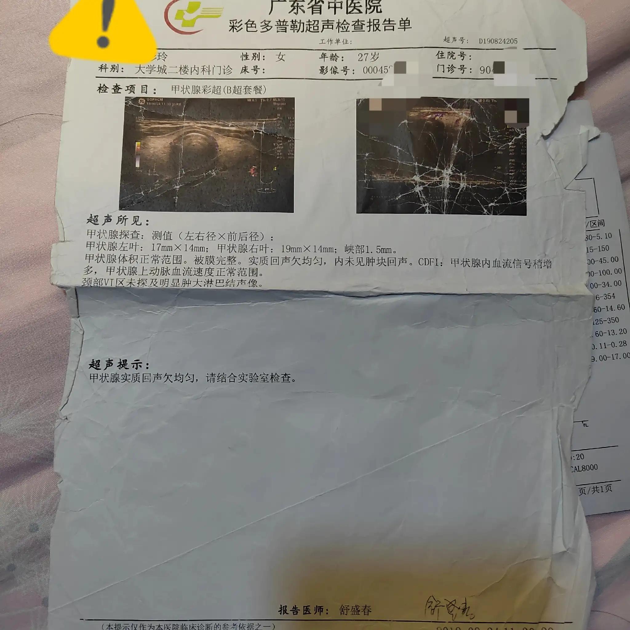 在治疗原发性甲亢的道路上给我带来的改变