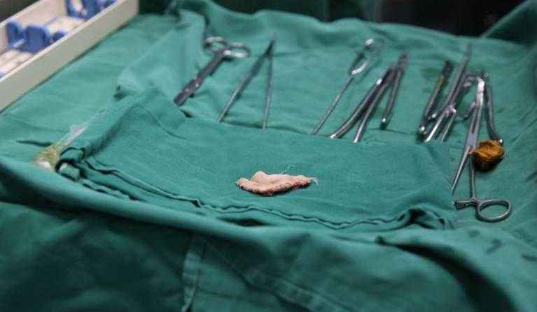 女子生产后纱布被留在体内两周多，其实并非一个人的错