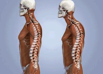 有些人看起来很正常其实有病,体型前凸后凸怎么改善