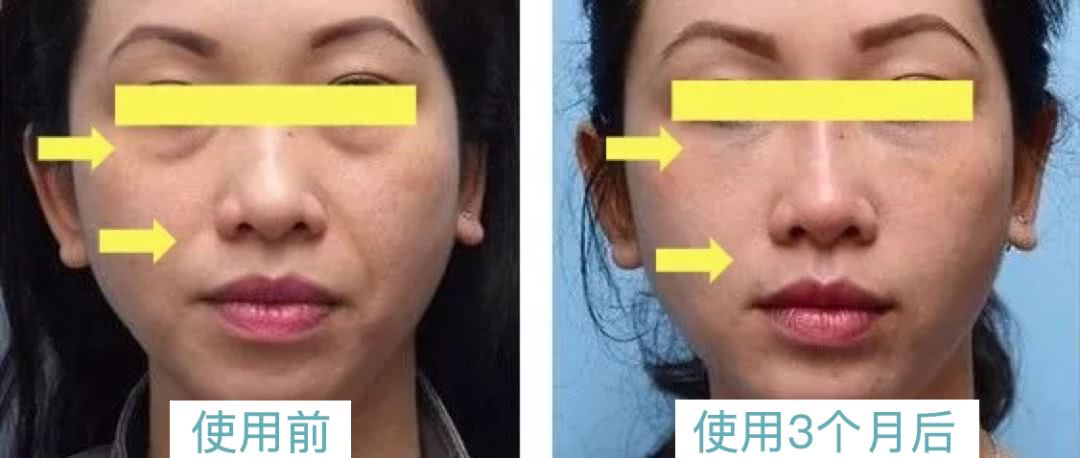 干货分享18篇,干货分享50篇