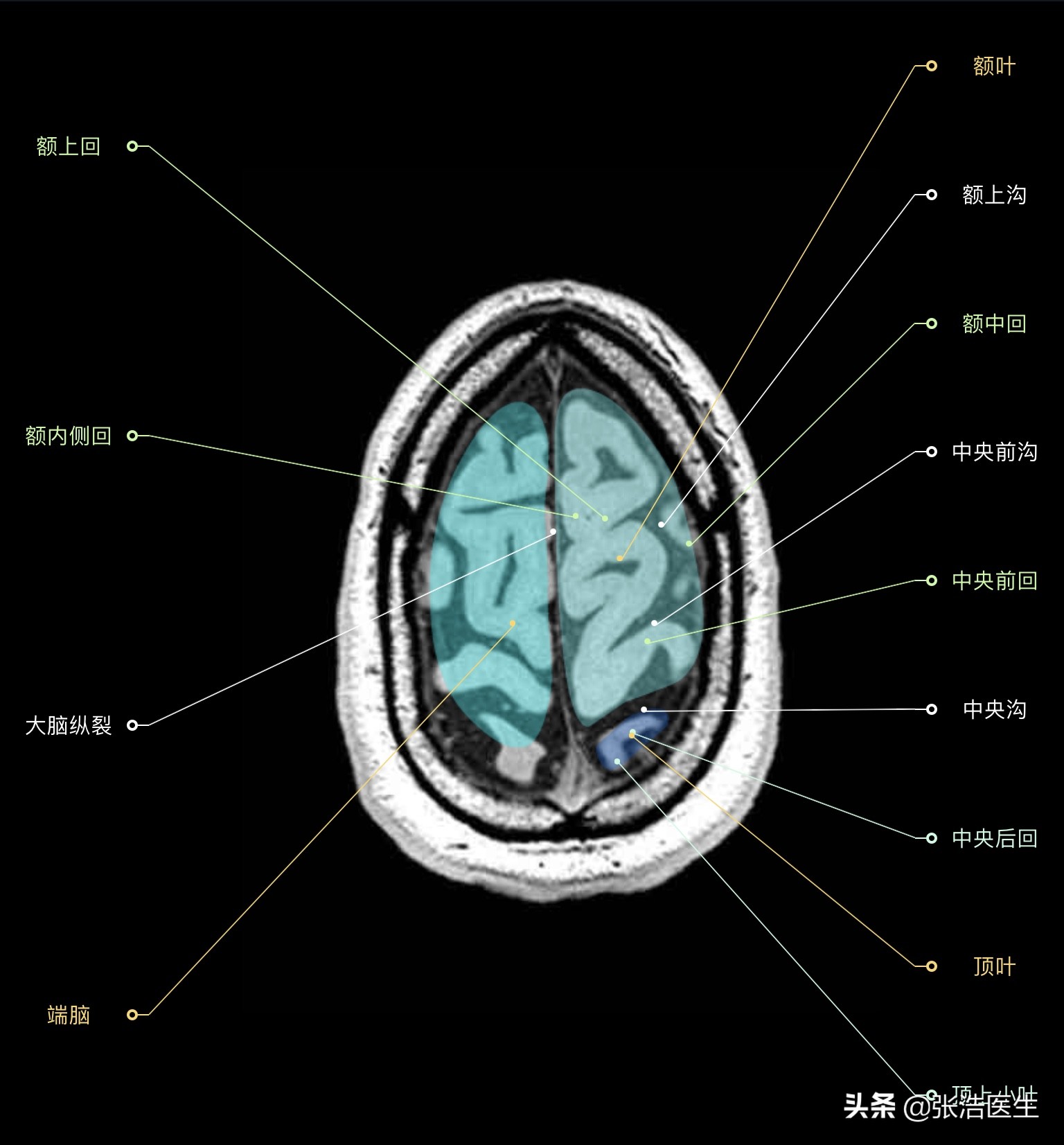 颅脑mri断层解剖视频课件,颅脑mri解剖手绘图