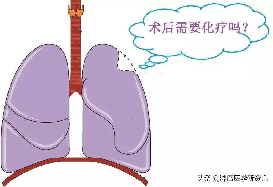 预测癌症免疫治疗效果的方法,预防免疫治疗癌症最新突破