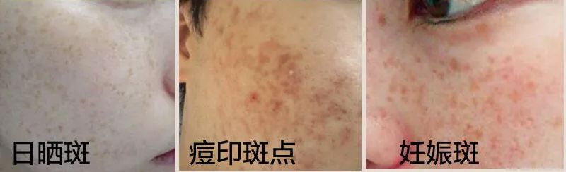 石头姐艾玛斯通拍摄,石头姐艾玛斯通新作品