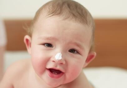 宝宝皮肤干痒脱皮泛红怎么改善,宝宝脸蛋干燥粗糙发红用什么护肤