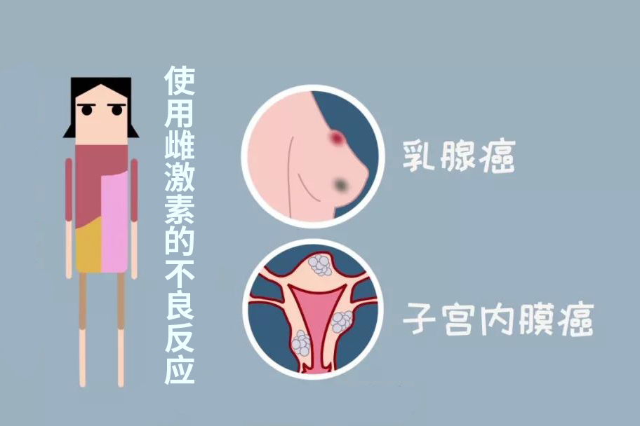 女性雌激素不足骨质疏松,老年女性骨质疏松能吃点雌激素吗