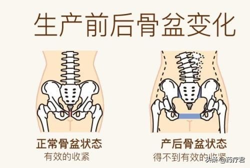 生完孩子之后，真的会有“妇女胯”吗？怎样才能重回少女胯？