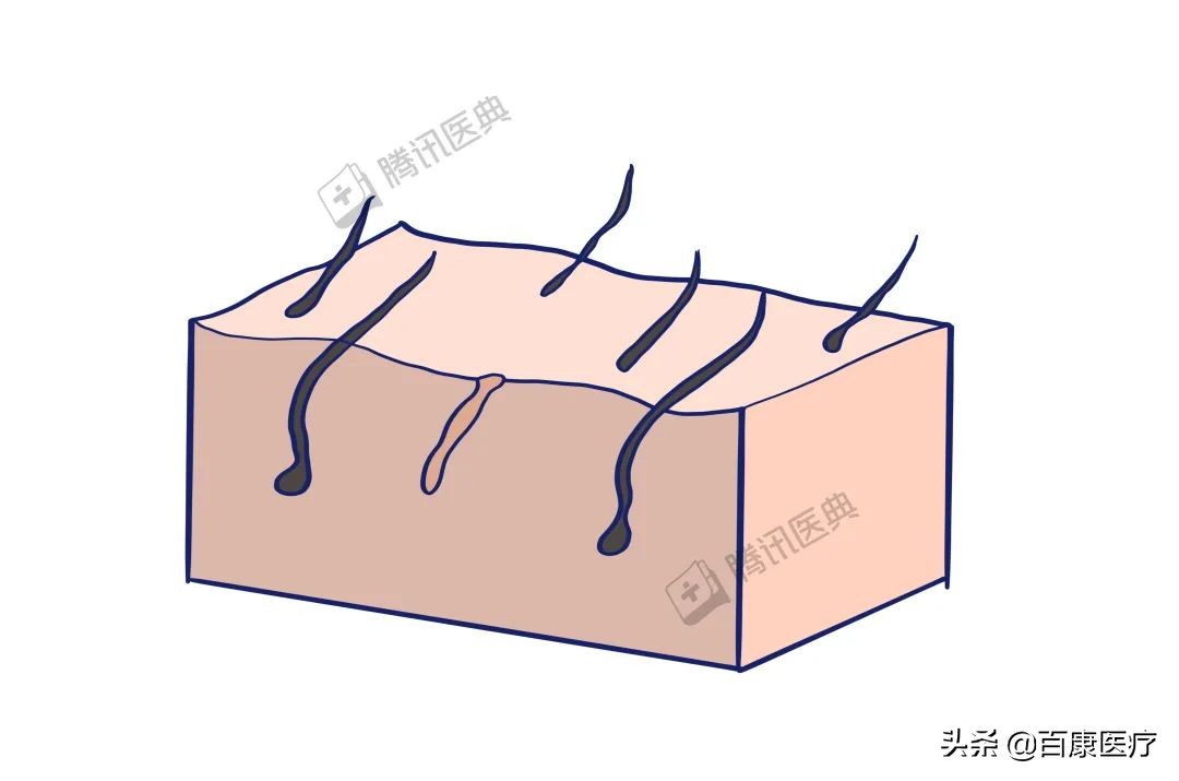 40岁男脱发恢复的真实经历,40岁脱发严重秃头怎么回事