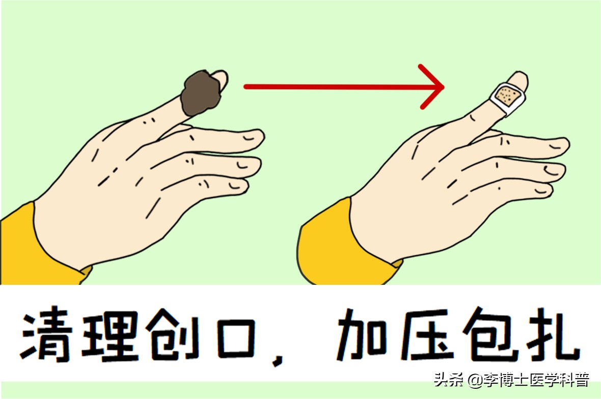 手部外伤急救,手部外伤家庭急救手抄报