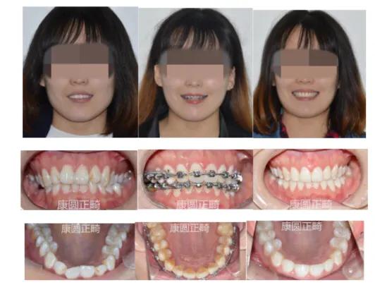 杭州萧山城厢韩薇口腔诊所,杭州余杭区口腔诊所有哪些