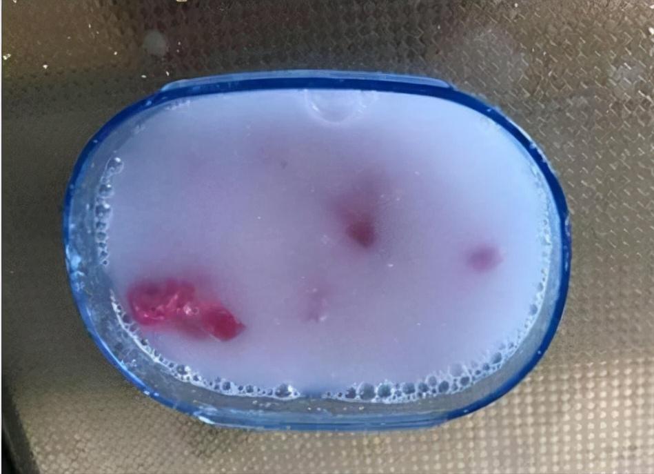 油烟机不管有多脏一个口罩就搞定,油烟机脏了别傻傻拆下来洗了