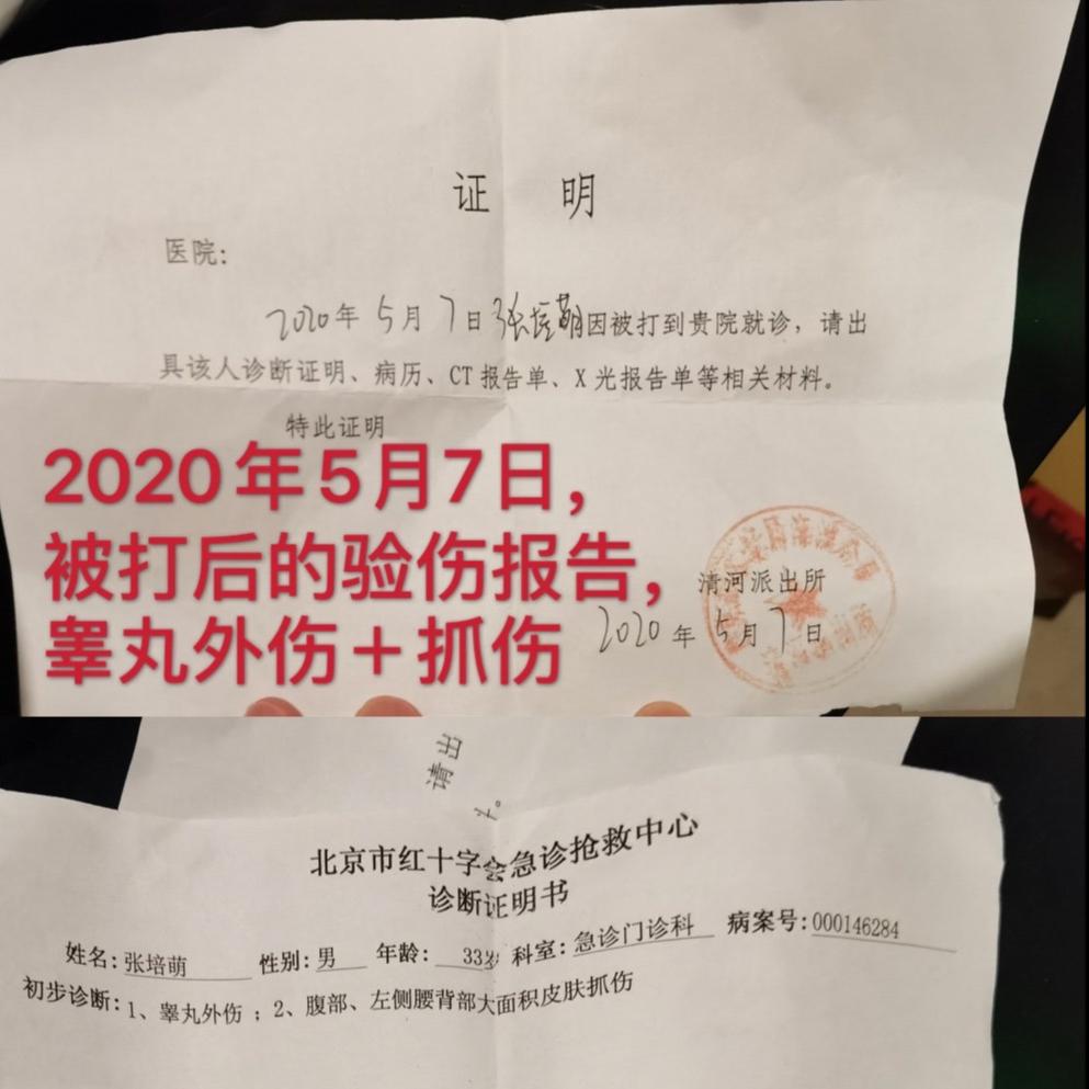 被拿刀追砍，抓伤*处私**，张培萌发文回应家暴，自己才是受害者