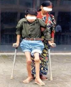 血友病基础常识题目,血友病儿童的预防性治疗