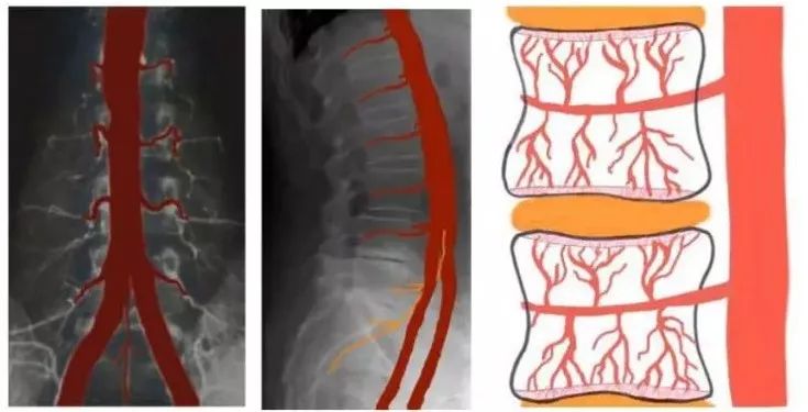 腰椎间盘突出坐骨神经痛如何缓解,腰椎间盘突出脚痛神经痛怎么缓解
