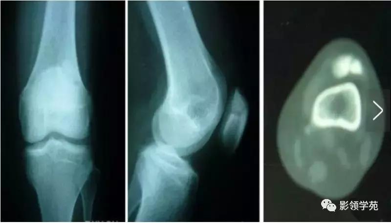 膝关节疼痛的问题各种各样的图片,膝关节疼痛的16种最常见原因速查