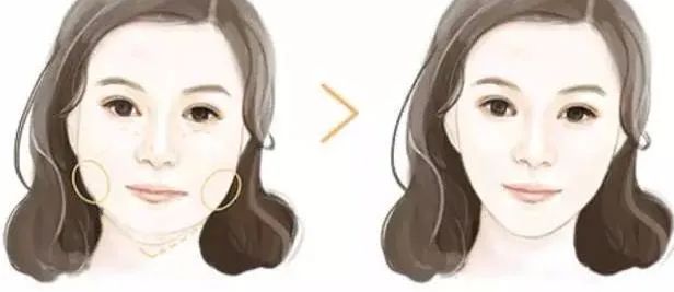 打瘦脸针能怀孕吗,打过瘦脸针怀孕了怎么办