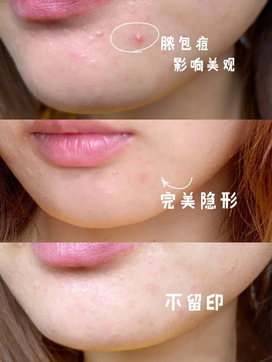 片仔癀祛痘痘产品,片仔癀可以改善痘痘肌吗