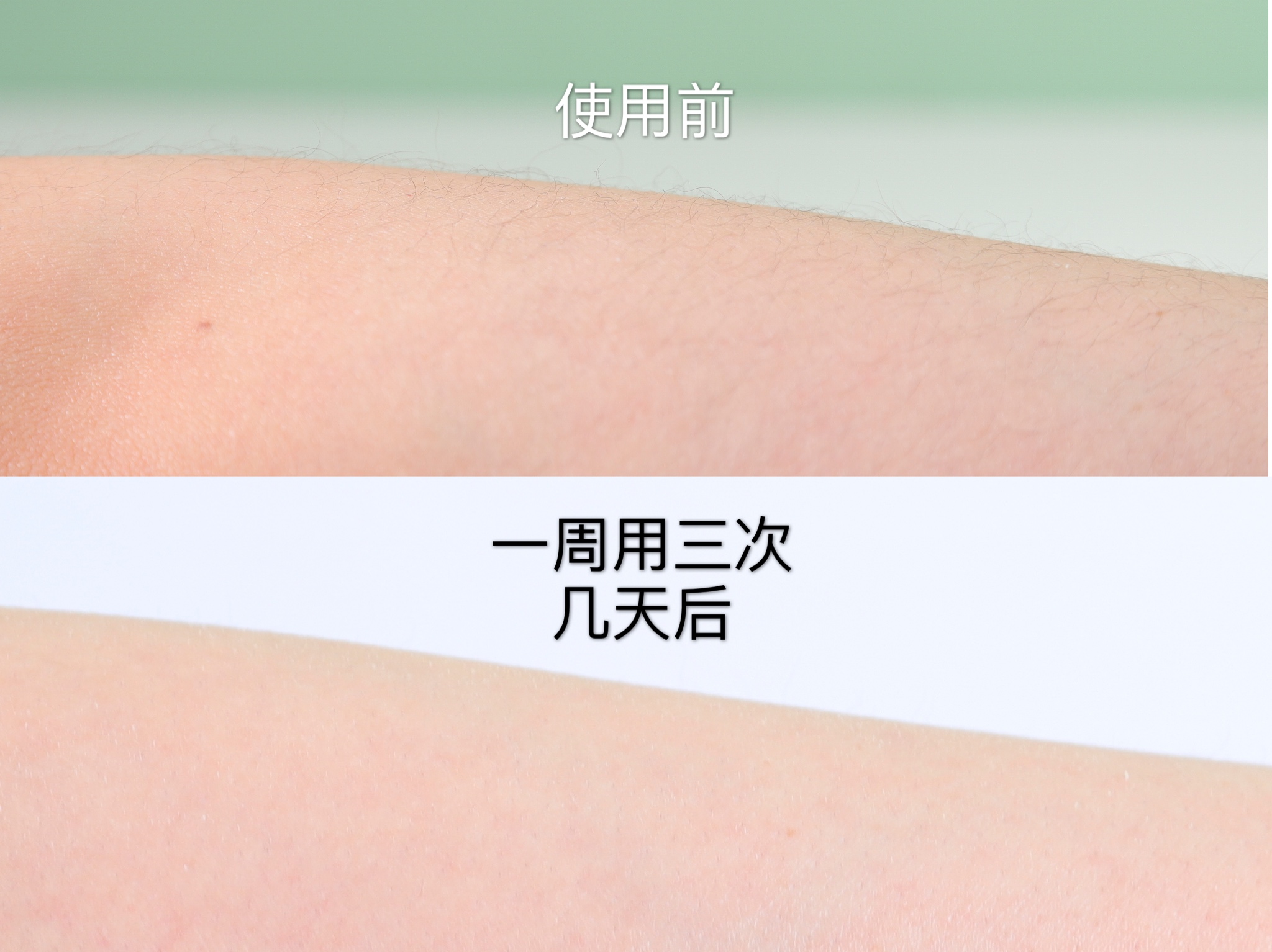 4款网红脱毛仪对比,ulike极萌脱毛仪涂鸦版