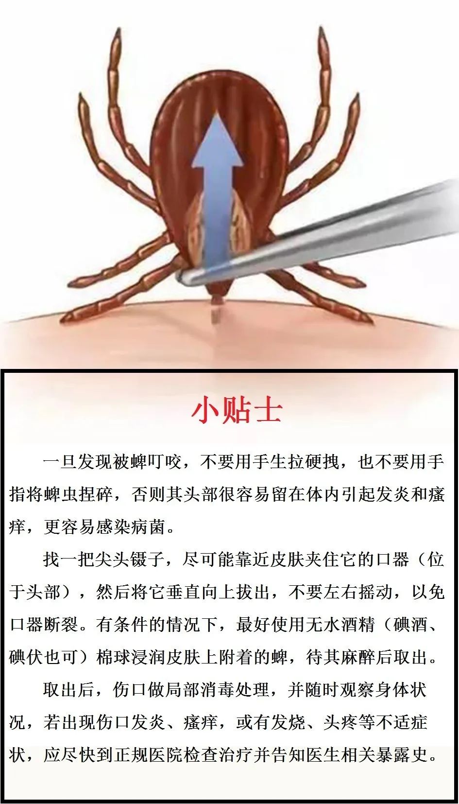 蜱虫病最多发烧几天能好,周口新冠肺炎发热门诊