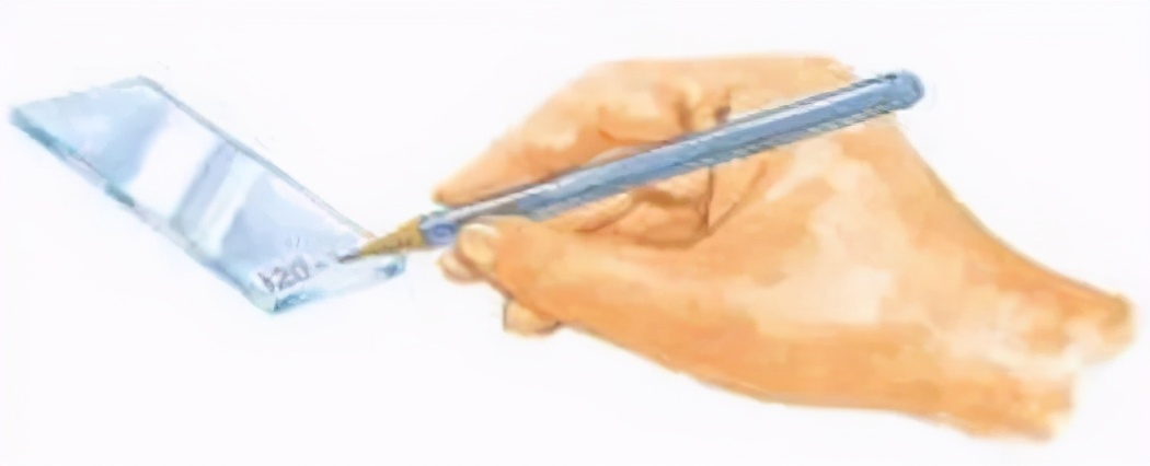 结核诊断方法和防治原则,结核的病原学诊断