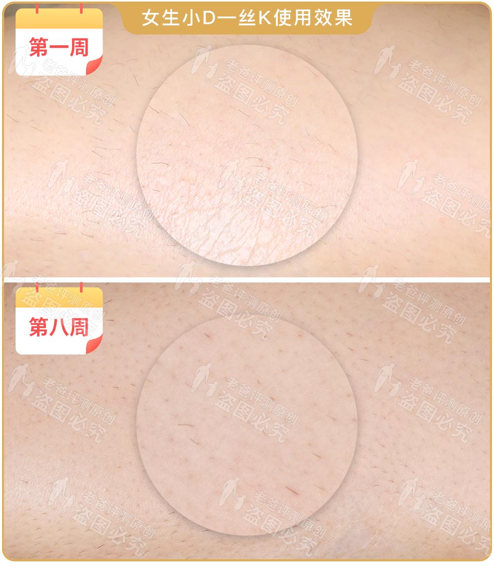 最真实的脱毛仪,bequeen脱毛仪实测