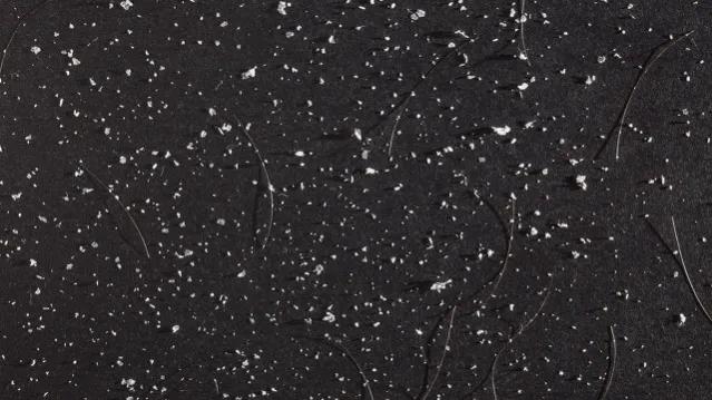 冬天裤子上很多白色皮屑怎么去除,冬天腿上干燥起白皮屑