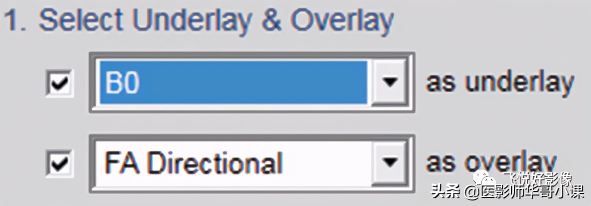 飞利浦磁共振波谱成像扫描技术,飞利浦磁共振纵隔扫描技术