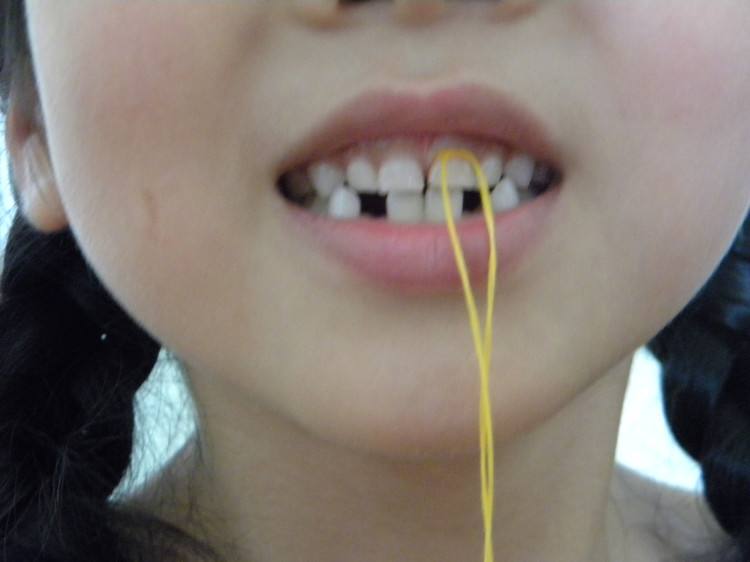 小孩长新牙需要多久,小孩长新牙应该注意哪些