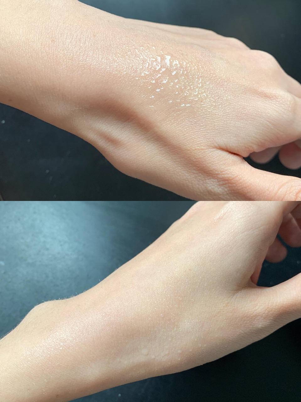 晒后修护可以涂抹晒伤的皮肤吗,晒伤后的刺痛感怎么消除