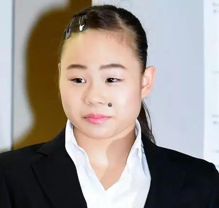 长在什么部位的痣最危险,长在哪些部位的痣需要特别注意