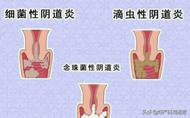 妇科过程的治疗方案是什么