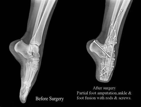 古代除了缠足还有哪些陋习,妇女缠足的陋习从哪个朝代开始