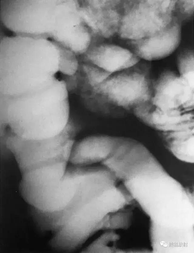 「收藏」11种消化道造影解剖图谱