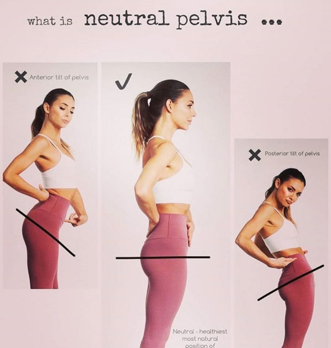 右侧骨盆前倾的最有效的矫正方法,下交叉综合症骨盆前倾矫正