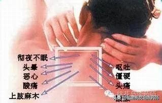 有颈椎病用颈椎枕有用吗,颈椎病适合用颈椎枕吗