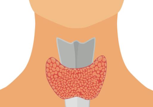 甲亢免疫修复介入治疗需要几次,腺体免疫介入修复可以治疗甲亢吗