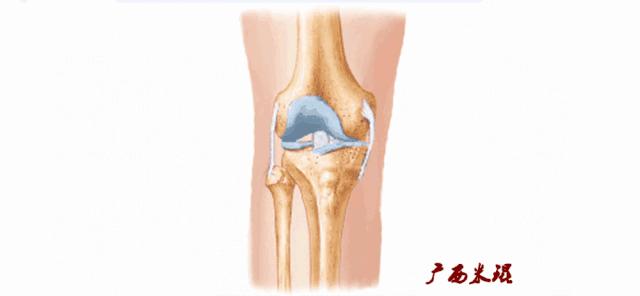 膝盖扭伤前交叉韧带损伤可以热敷,前交叉韧带扭伤最快自愈方法