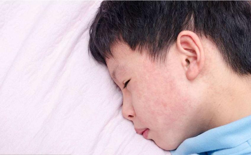 婴儿被老人亲了发高烧,小孩被陌生人亲感染一直不好