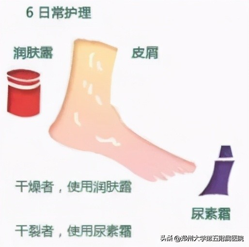 老茧疼痛怎么去除,去除手部老茧